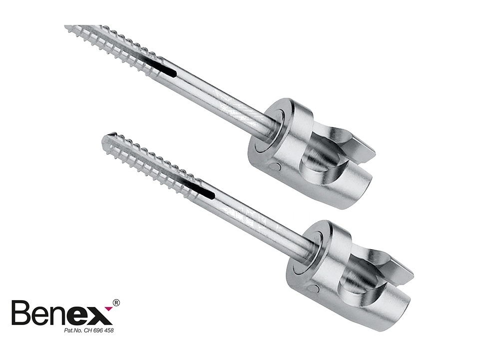 Large Benex Extracing System – Screw Only – 16 Mm, Diam. 1.6 Mm Inchlinch = Long Packing Unit = 2 Pieces